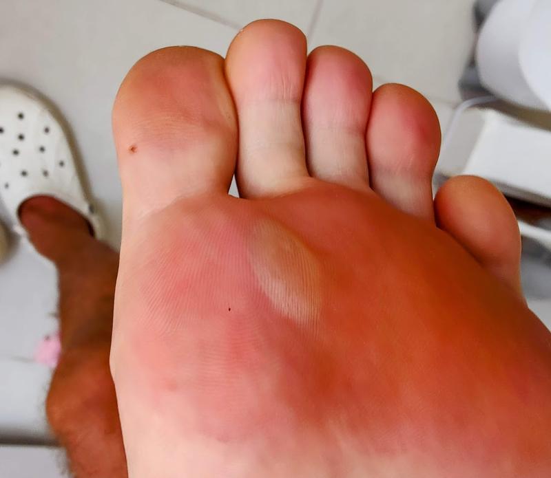 barefoot foot